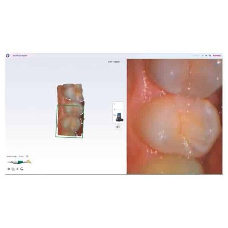 Emerald S Escaner Intraoral - Imagen 2