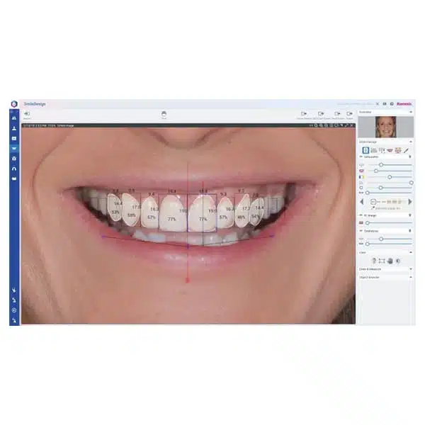 Romexis Smile Design - Imagen 3